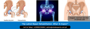 Hip Labral Repair Rehabilitation