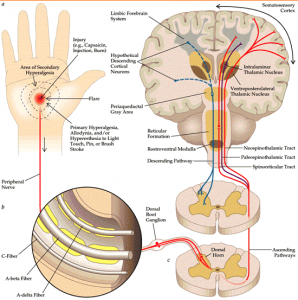 Acute Pain - home service physical therapy