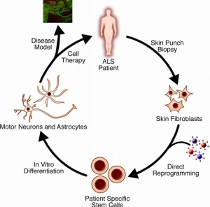 Handout image shows a flow chart illustrating the process by which stem cell lines are generated directly from amyotrophic lateral sclerosis patients