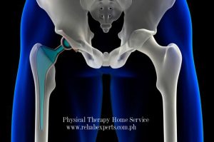 Home Instructions For Hip Replacement Patients